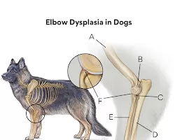 elbow dysplasia